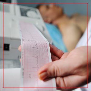EKG Testing in Sarasota, FL